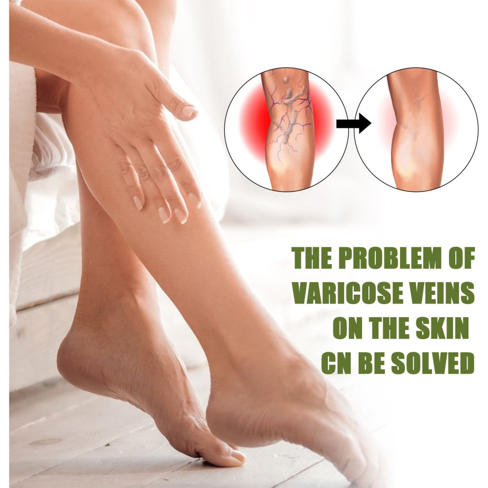 Lovild Varicose Veins Relief Spray