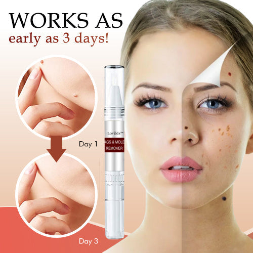 Lovilds Tags and Moles Remover Cream