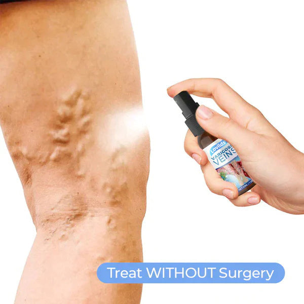 Lovild Varicose Veins Relief Spray