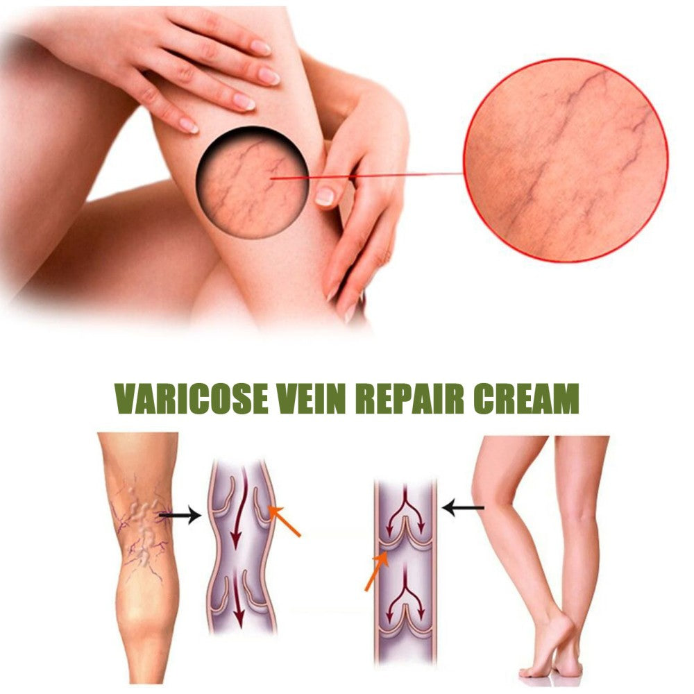 Lovild Varicose Veins Relief Spray