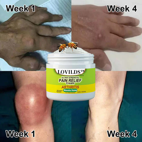 🐝New Zealand Bee Poison Joint and Bone Therapy Advanced Cream