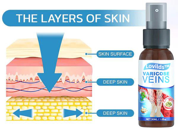 Lovild Varicose Veins Relief Spray