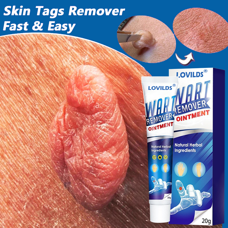 LOVILDS Wart Remover Ointment