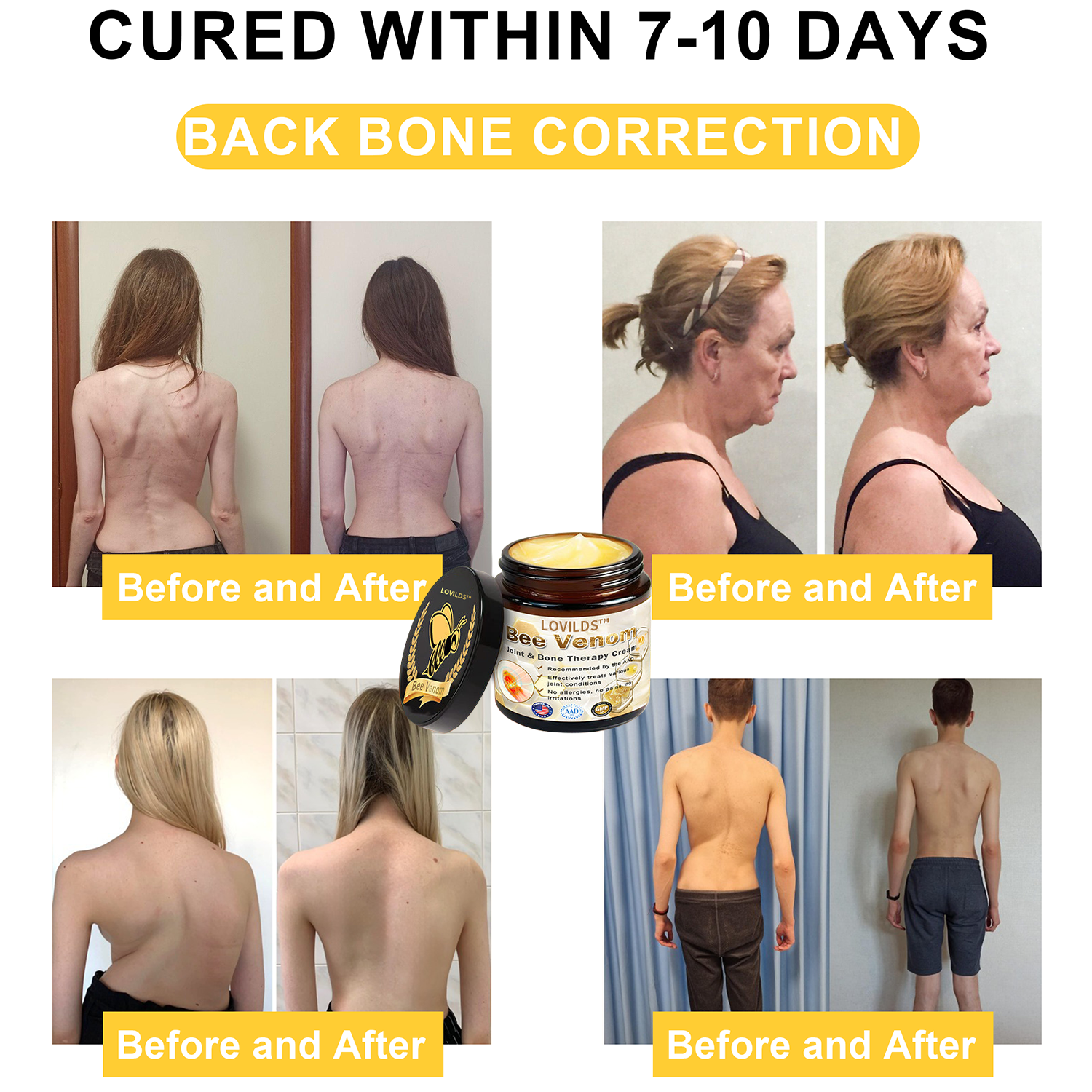 Arthritis Therapy Cream for Joint and Orthopedic Pain