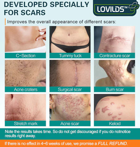 LOVILDS Advanced Scar Repair Spray for Acne Scars, Surgical Scars and Stretch Marks