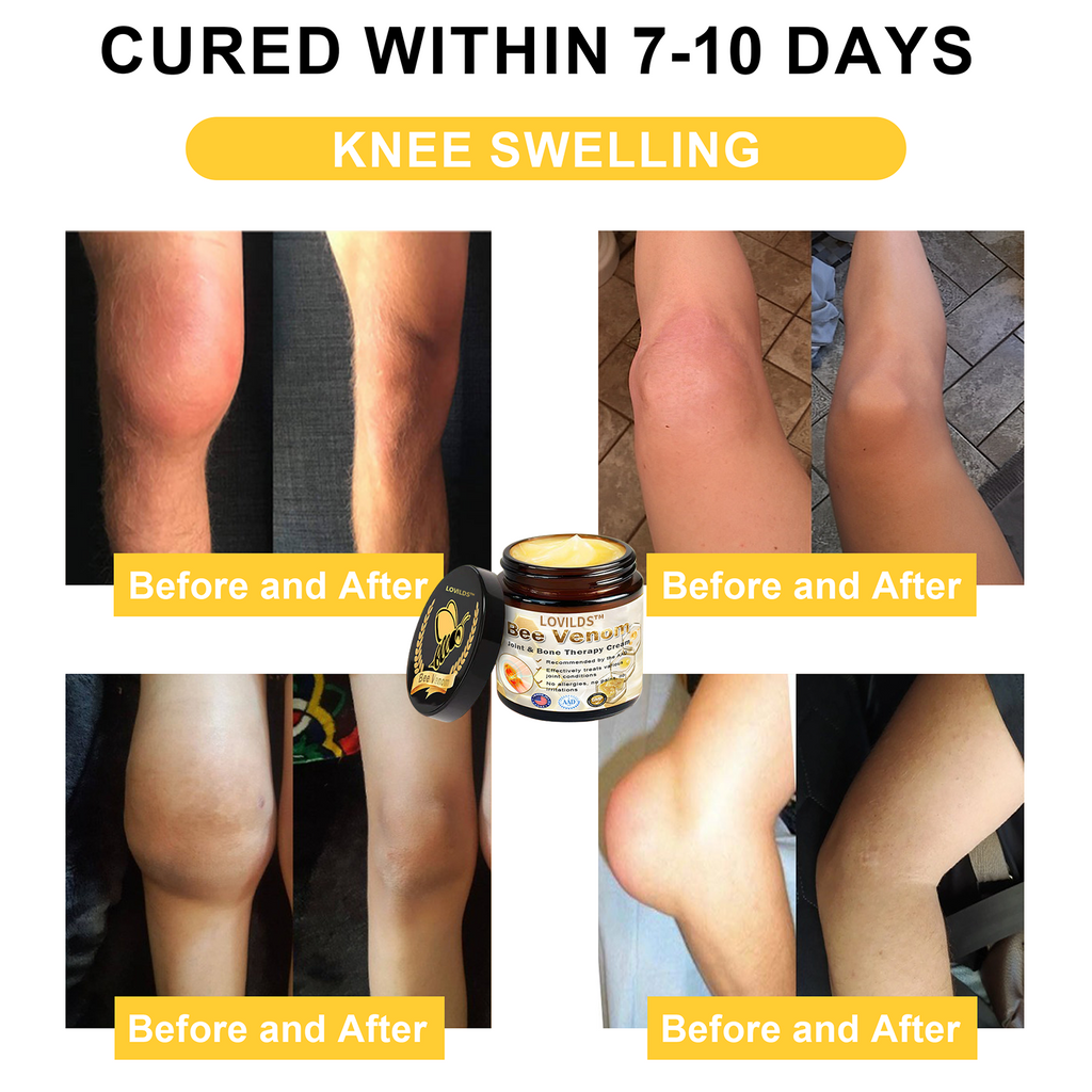 Arthritis Therapy Cream for Joint and Orthopedic Pain