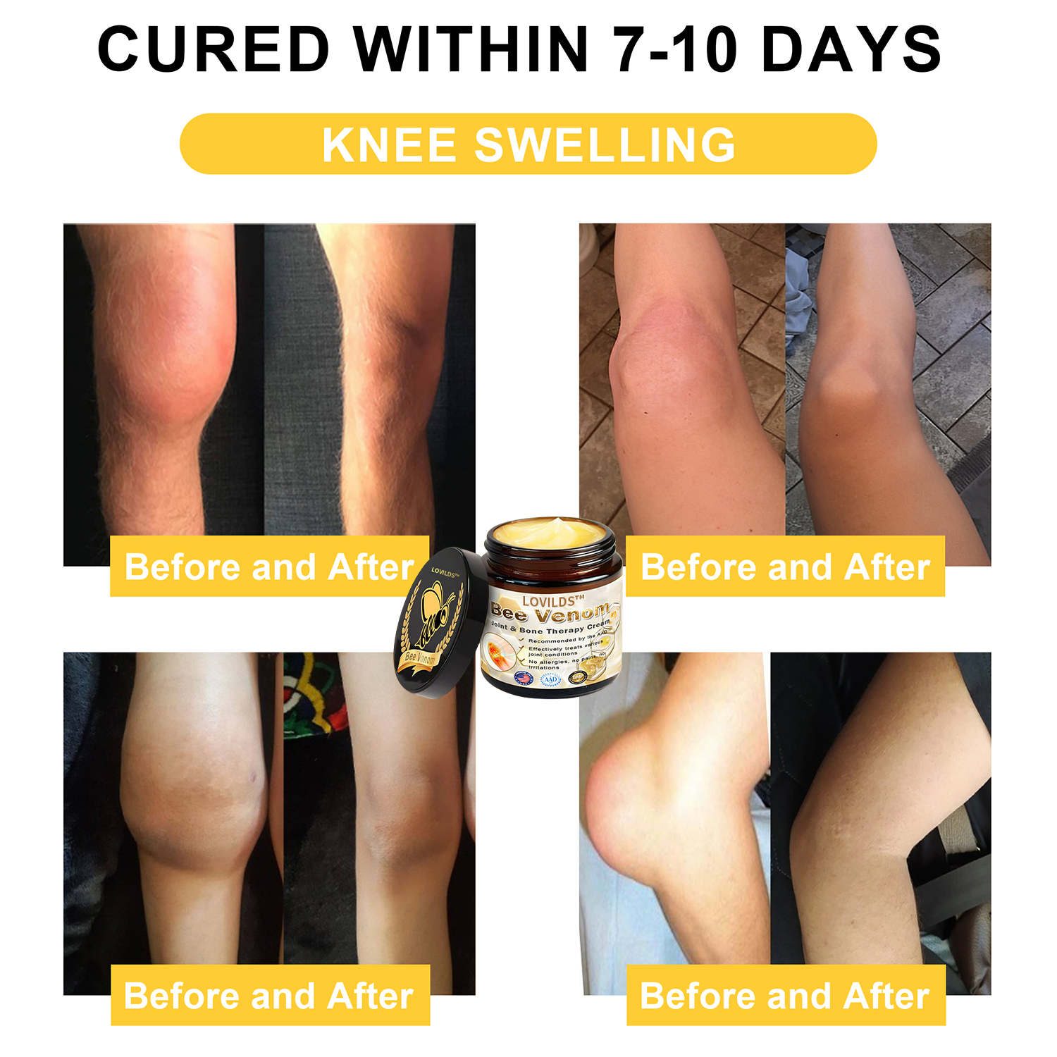 Arthritis Therapy Cream for Joint and Orthopedic Pain