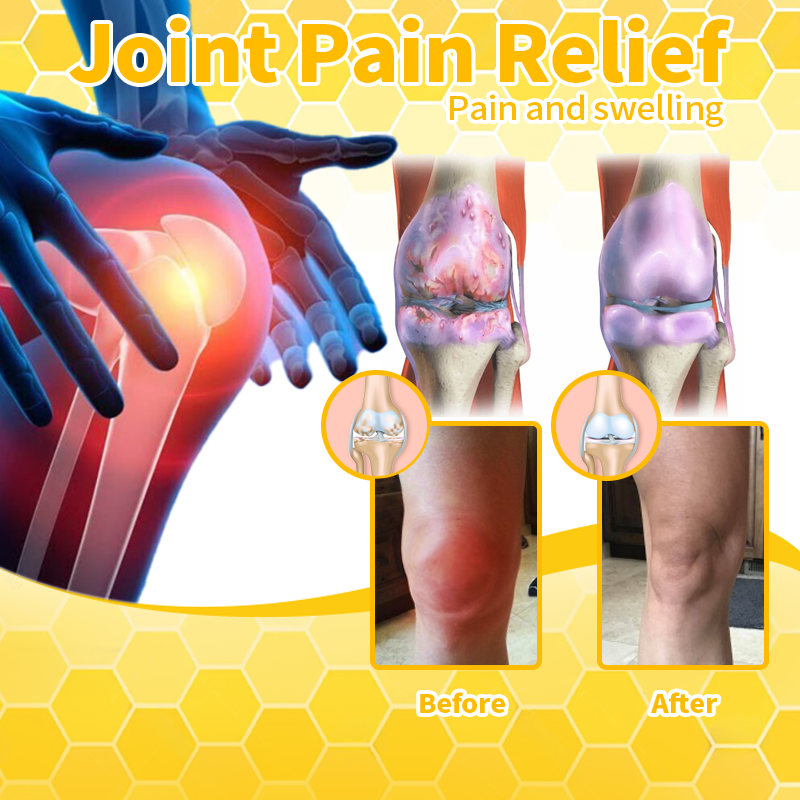 Arthritis Therapy Cream for Joint and Orthopedic Pain