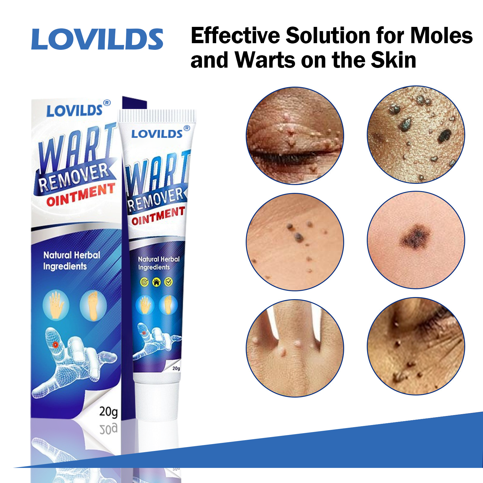 LOVILDS Wart Remover Ointment
