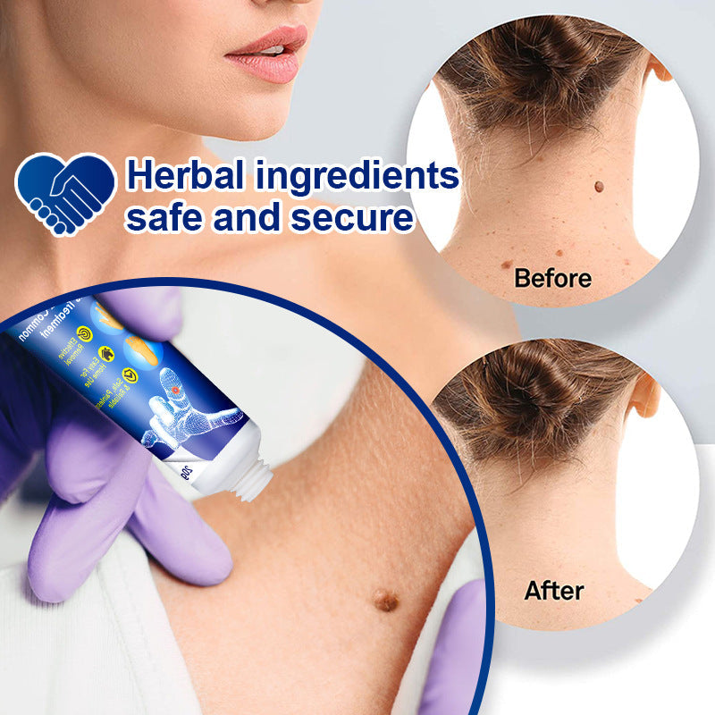 LOVILDS Wart Remover Ointment