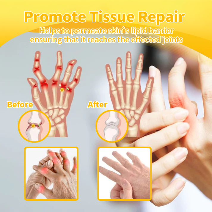 Arthritis Therapy Cream for Joint and Orthopedic Pain